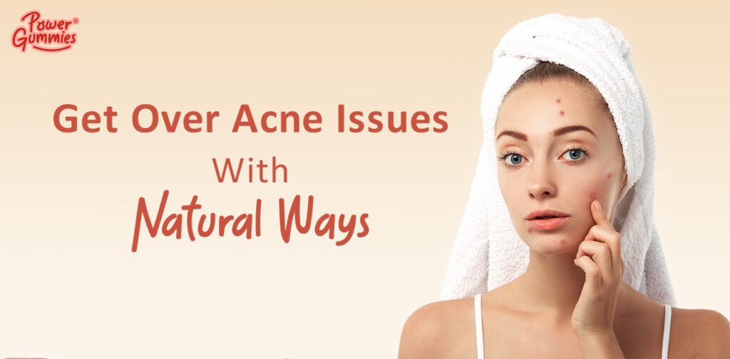 Natural Skincare Ways To Get Rid of Acne.